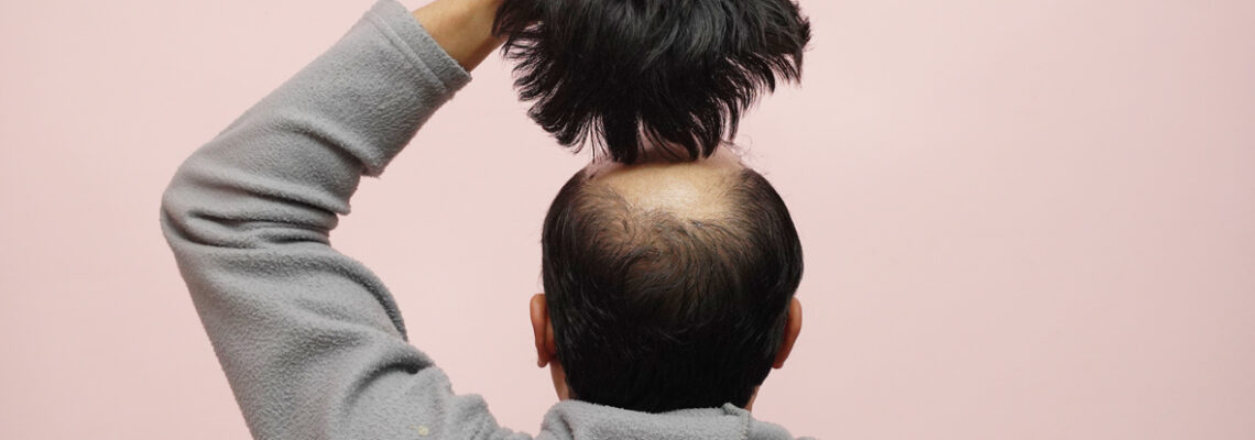 perruques pour hommes