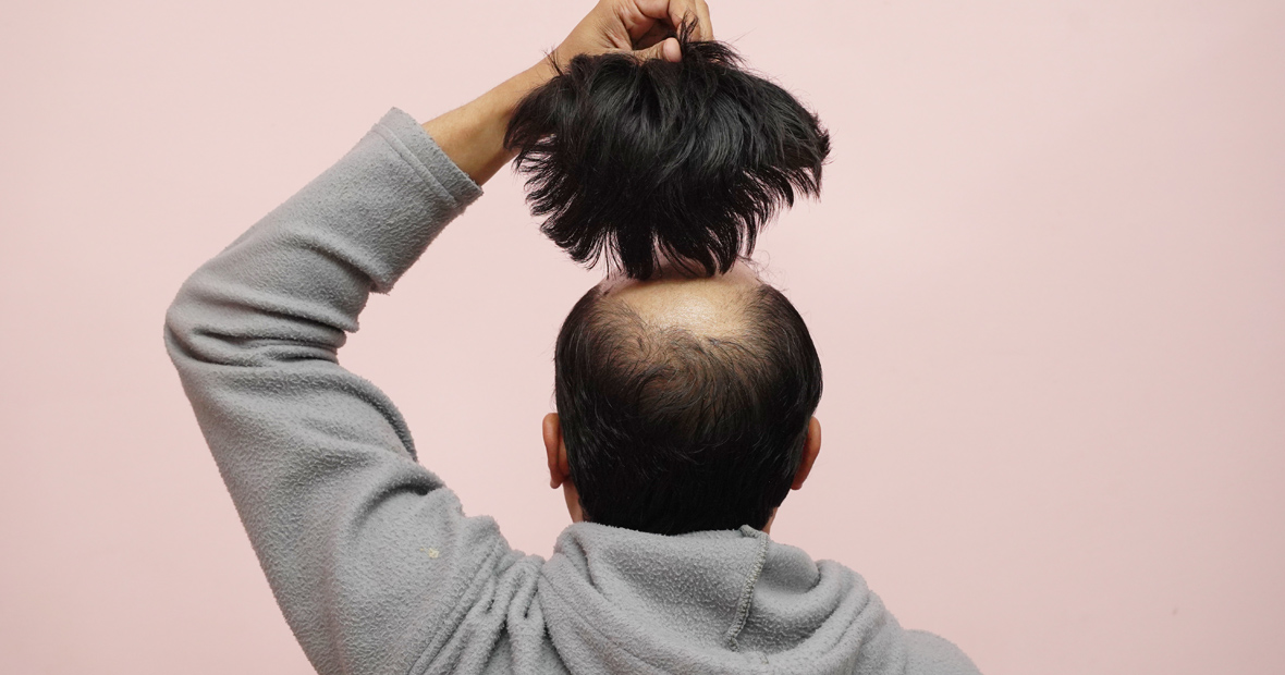 perruques pour hommes